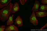 PCYT1A Antibody in Immunocytochemistry (ICC/IF)
