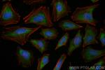 NEDD4 Antibody in Immunocytochemistry (ICC/IF)