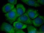 MMP1 Antibody in Immunocytochemistry (ICC/IF)