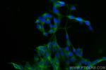 CELSR2 Antibody in Immunocytochemistry (ICC/IF)