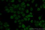 NSD3 Antibody in Immunocytochemistry (ICC/IF)