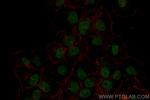 HNRPDL Antibody in Immunocytochemistry (ICC/IF)