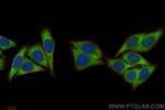 RNF31/HOIP Antibody in Immunocytochemistry (ICC/IF)