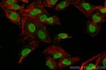 INTS5 Antibody in Immunocytochemistry (ICC/IF)