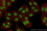 HOXB6 Antibody in Immunocytochemistry (ICC/IF)