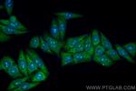 TYK2 Antibody in Immunocytochemistry (ICC/IF)