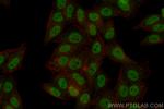 HIC2 Antibody in Immunocytochemistry (ICC/IF)
