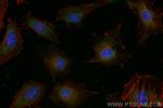 ROCK1 Antibody in Immunocytochemistry (ICC/IF)