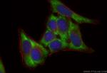 SAR1A Antibody in Immunocytochemistry (ICC/IF)