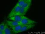 TRIM54 Antibody in Immunocytochemistry (ICC/IF)