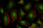 TPR Antibody in Immunocytochemistry (ICC/IF)