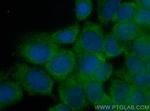 MMP13 Antibody in Immunocytochemistry (ICC/IF)