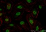 HIRA Antibody in Immunocytochemistry (ICC/IF)