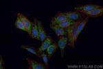 NDUFB8 Antibody in Immunocytochemistry (ICC/IF)