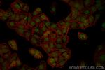 SLC12A8 Antibody in Immunocytochemistry (ICC/IF)