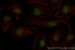 MLLT1 Antibody in Immunocytochemistry (ICC/IF)