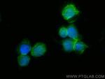DOCK8 Antibody in Immunocytochemistry (ICC/IF)
