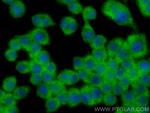 SAT1 Antibody in Immunocytochemistry (ICC/IF)