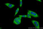 RPS18 Antibody in Immunocytochemistry (ICC/IF)
