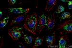 AGXT Antibody in Immunocytochemistry (ICC/IF)