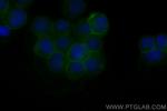Fas/CD95 Antibody in Immunocytochemistry (ICC/IF)