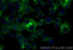 Osteopontin Antibody in Immunocytochemistry (ICC/IF)