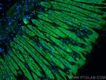 Osteopontin Antibody in Immunohistochemistry (Paraffin) (IHC (P))