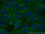 PLK2 Antibody in Immunocytochemistry (ICC/IF)