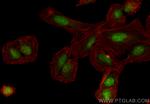 THOC5 Antibody in Immunocytochemistry (ICC/IF)
