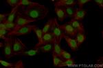ESR2 Antibody in Immunocytochemistry (ICC/IF)