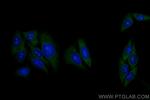 LAMR1, RPSA Antibody in Immunocytochemistry (ICC/IF)