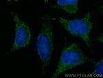 MRPL40 Antibody in Immunocytochemistry (ICC/IF)