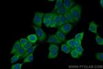 RPS11 Antibody in Immunocytochemistry (ICC/IF)