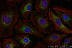SOD2 Antibody in Immunocytochemistry (ICC/IF)