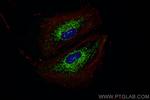 SOD2 Antibody in Immunocytochemistry (ICC/IF)