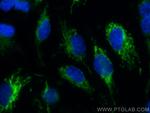 SOD2 Antibody in Immunocytochemistry (ICC/IF)