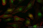 ANAPC10 Antibody in Immunocytochemistry (ICC/IF)