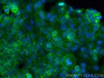 Dystrophin Antibody in Immunocytochemistry (ICC/IF)