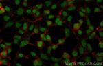 C1orf83 Antibody in Immunocytochemistry (ICC/IF)