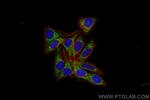 DLAT Antibody in Immunocytochemistry (ICC/IF)