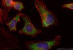 MTMR9 Antibody in Immunocytochemistry (ICC/IF)
