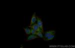 Beta galactosidase Antibody in Immunocytochemistry (ICC/IF)