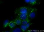 Cathepsin D Antibody in Immunocytochemistry (ICC/IF)