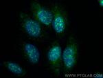 SON Antibody in Immunocytochemistry (ICC/IF)