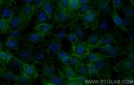 EGFR Antibody in Immunocytochemistry (ICC/IF)
