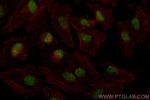 TP53BP1 Antibody in Immunocytochemistry (ICC/IF)