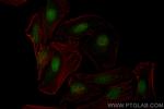 TRMT6 Antibody in Immunocytochemistry (ICC/IF)