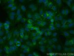 SLC31A1 Antibody in Immunocytochemistry (ICC/IF)