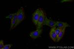 FAM127B Antibody in Immunocytochemistry (ICC/IF)