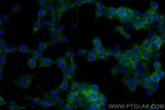 NCAM1/CD56 Antibody in Immunocytochemistry (ICC/IF)